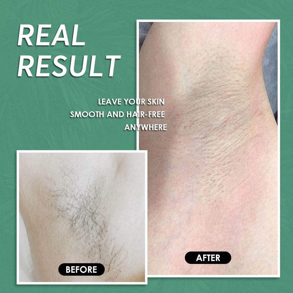 Maxpearl wax beads body hair removal kit for full-body sessions.