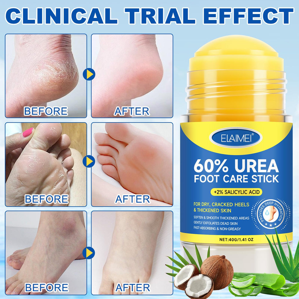 Mcukv Urea Cream Stick absorbs quickly with no greasy residue