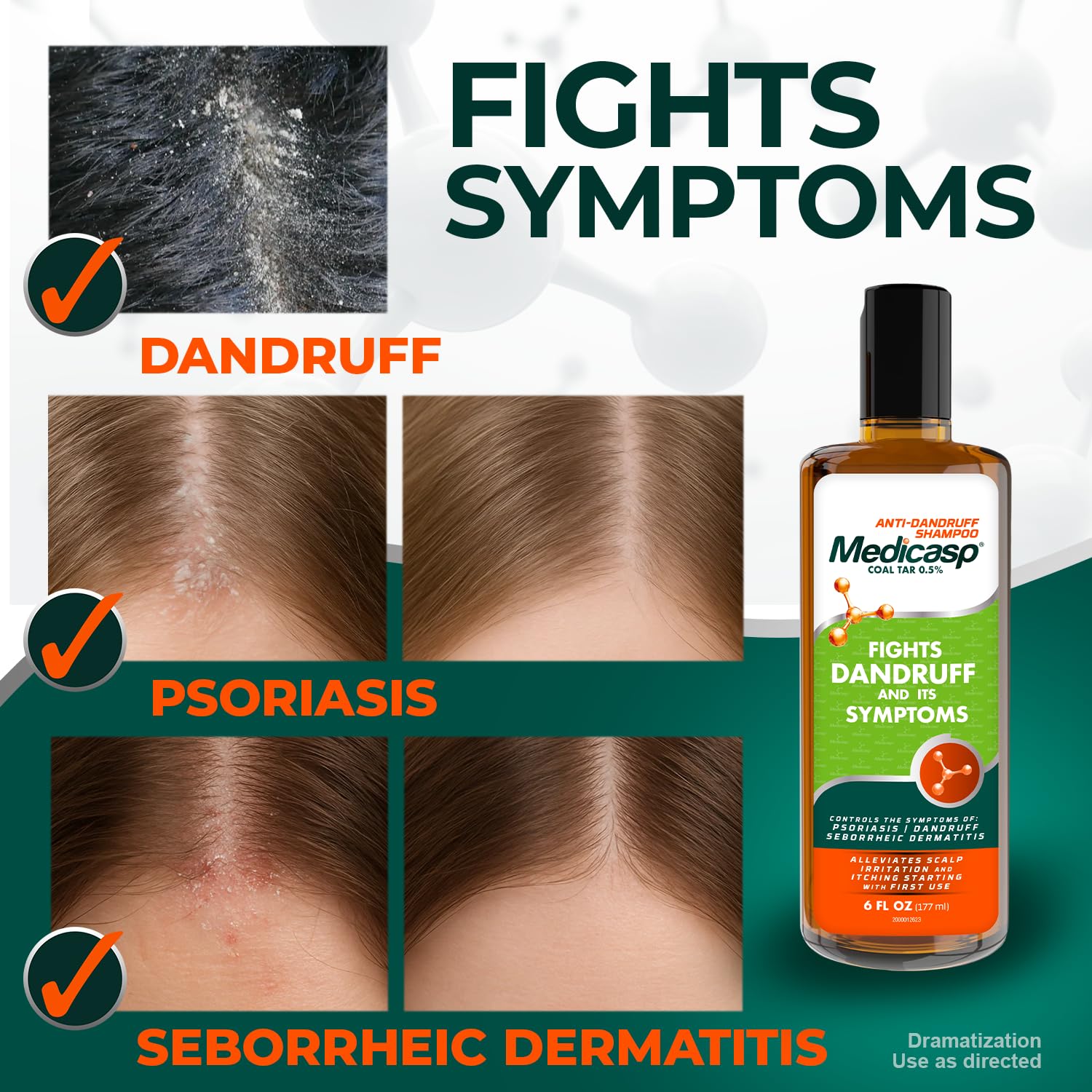 Medicasp Coal Tar Anti-Dandruff Shampoo targets psoriasis symptoms with medicated care.