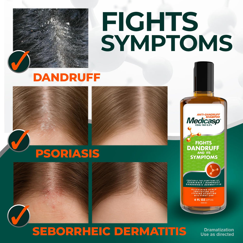 Medicasp shampoo application foam shows easy distribution and soothing lather.