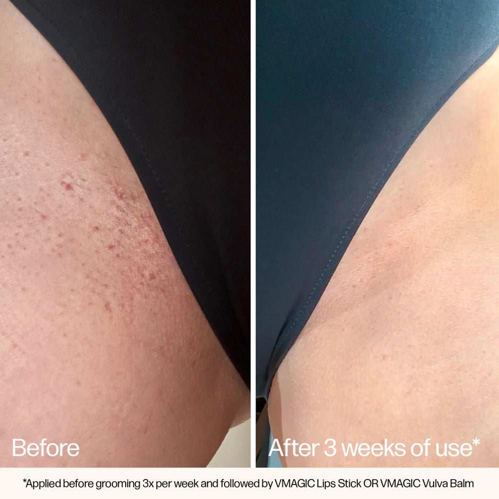 VMAGIC hands applying in bikini area highlight prep for waxing or shaving.