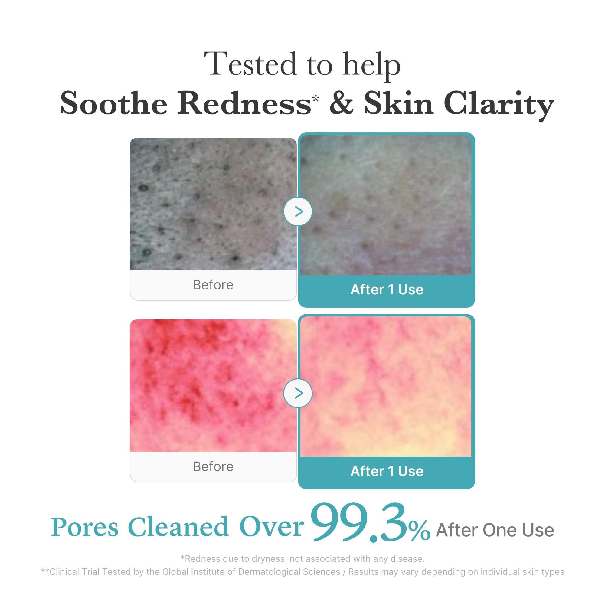 medicube Azelaic Acid Gummy Whip Cleanser niacinamide glow close-up hints balanced skin tone for daily care