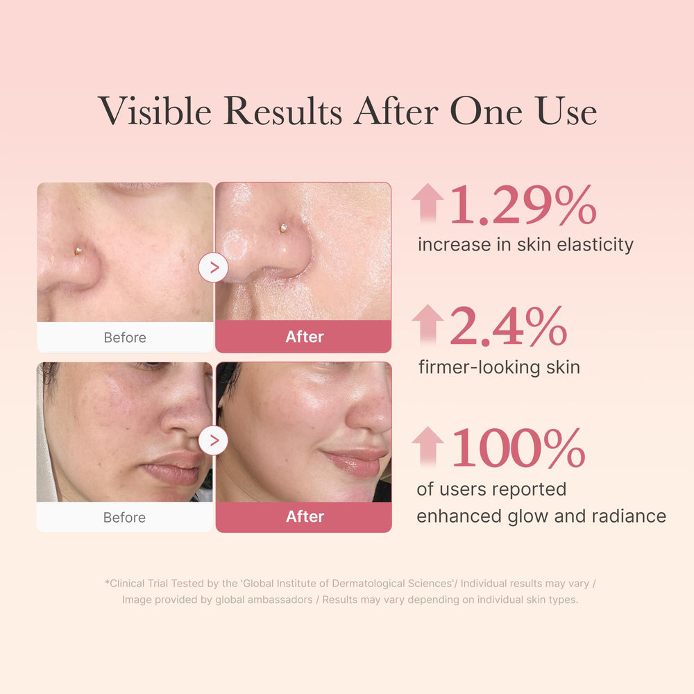 Medicube Collagen Jelly Cream evening application demonstrates nourishment.