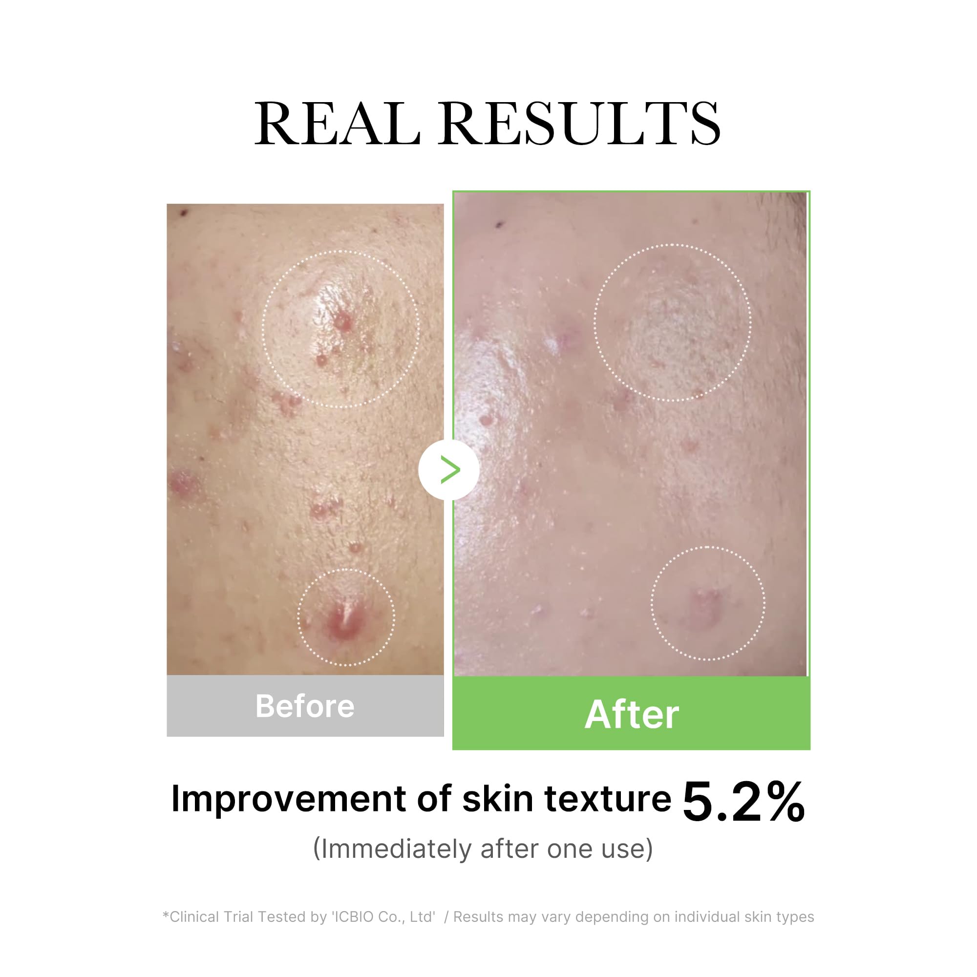 Medicube Exosome Cica Tea Tree Ampoule swirl hints at smoother texture and calm skin.