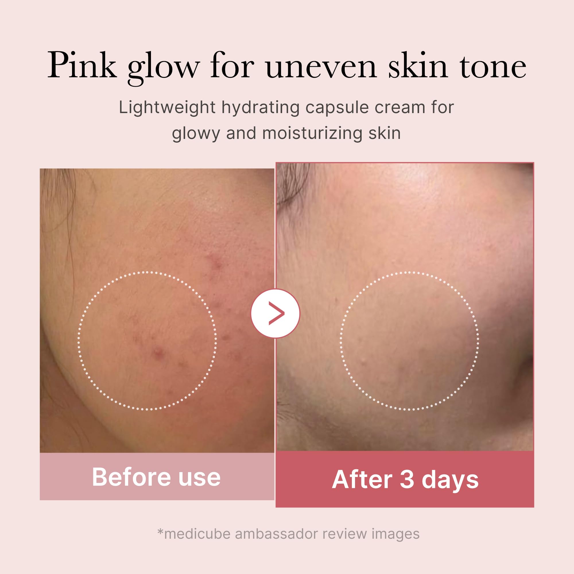 Medicube bottle with pink cap demonstrates easy-at-home skincare routine.