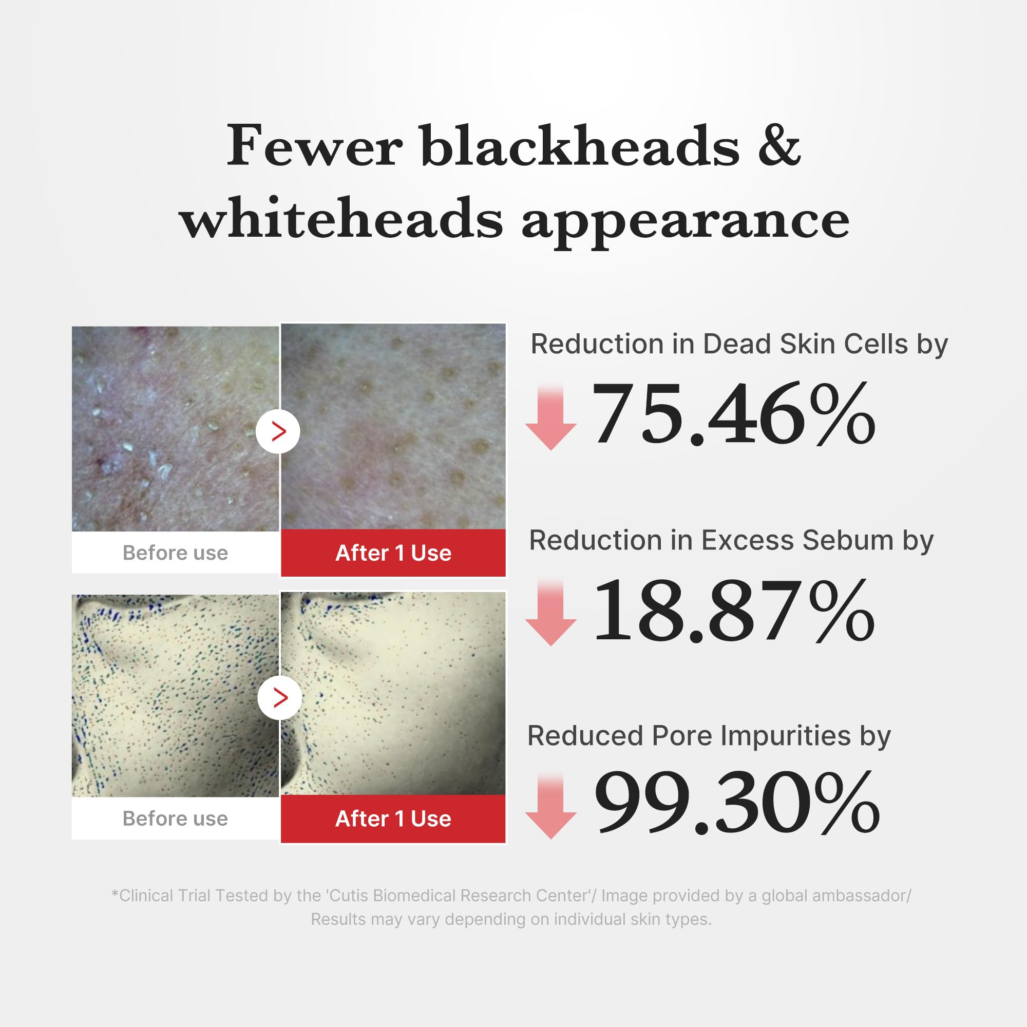 Medicube pore-care focus illustrates smoother-looking pores and refined texture