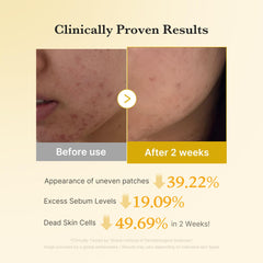 medicube Kojic Acid Turmeric Toner Pad glycolic action softens rough patches