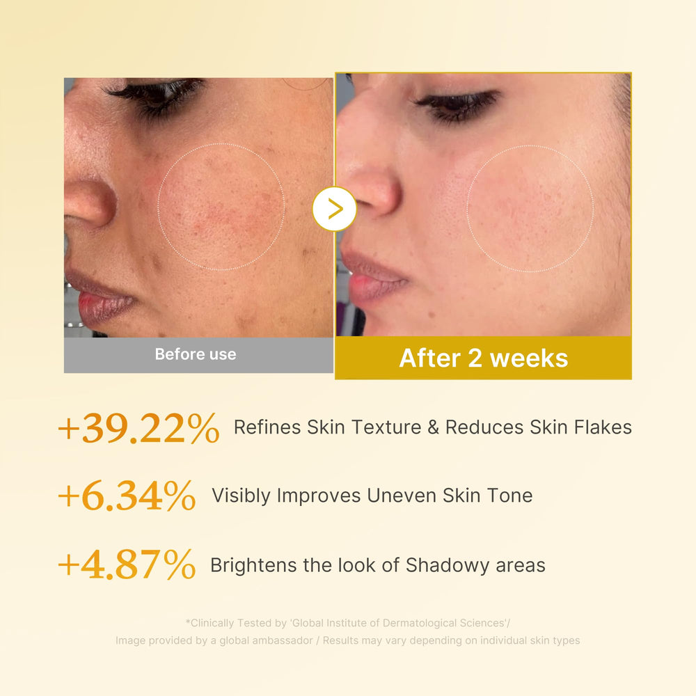 Medicube Kojic Turmeric Toner cotton-pad application for even tone