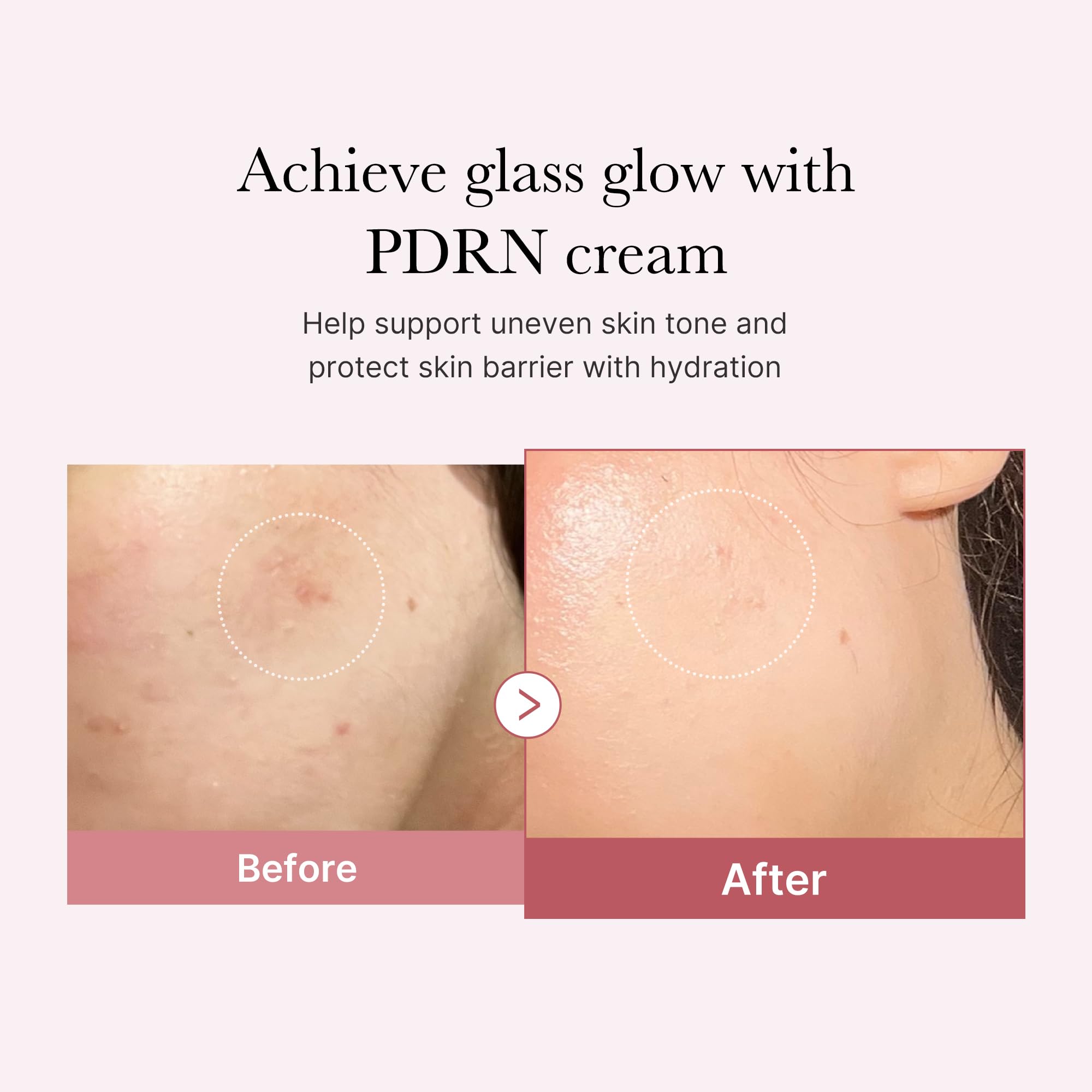 Close-up of Medicube PDRN Pink Hyaluronic Cream texture for smooth, non-greasy feel.