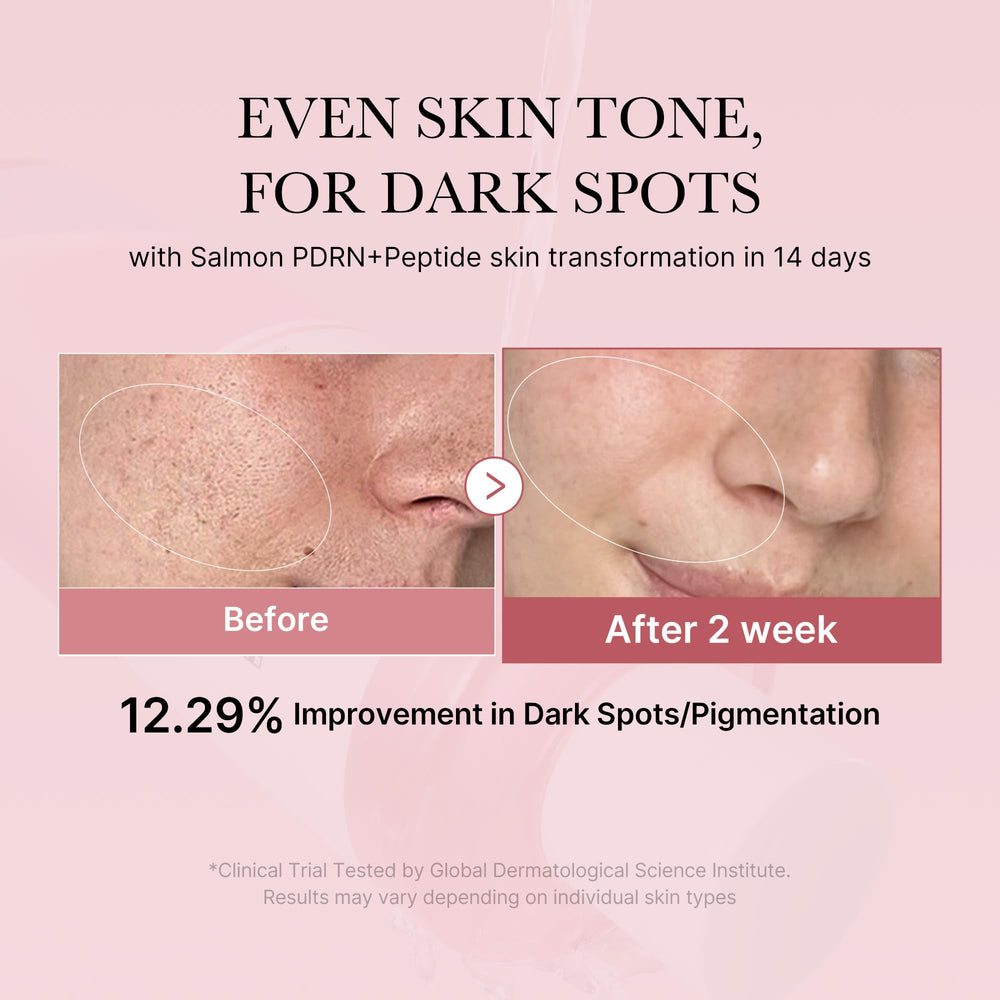 Medicube Pink Glow Toner is applied with a cotton pad for gentle renewal.