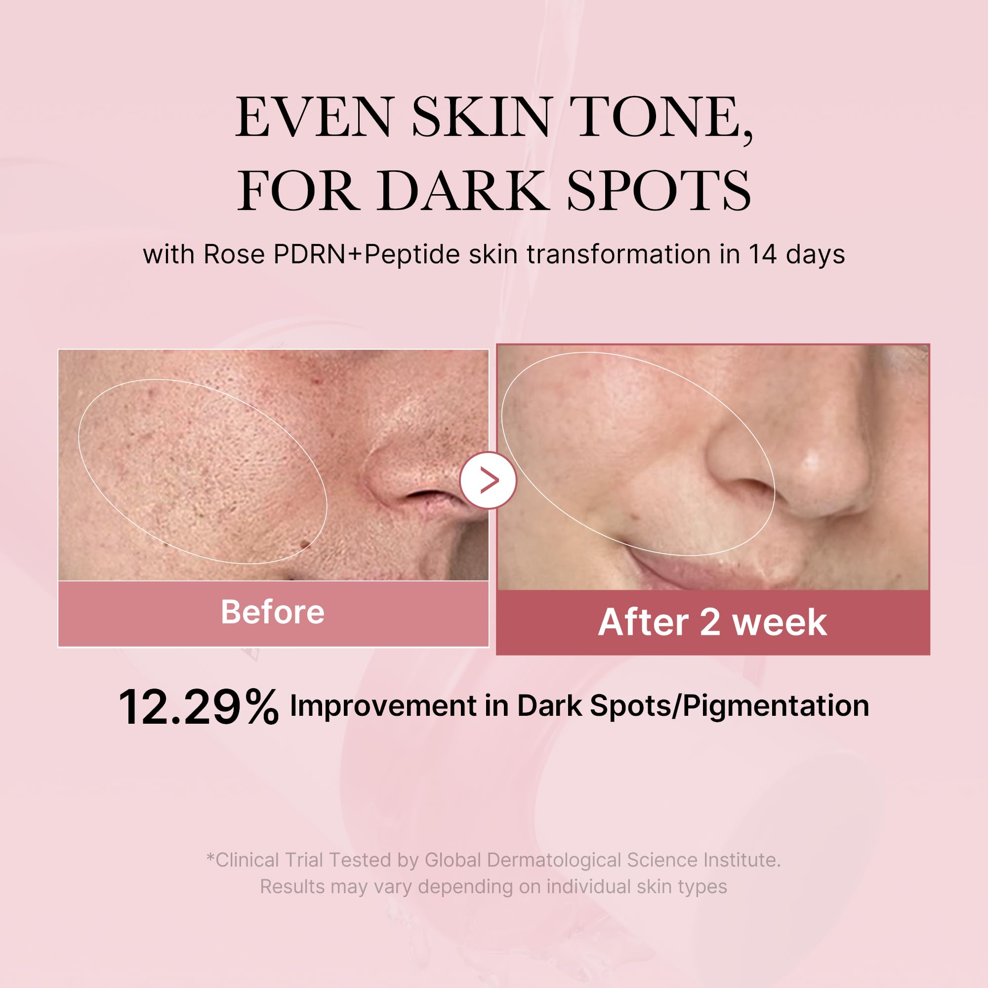 Medicube Pink Glow Toner swirl on skin suggests radiant, even-toned complexion potential.