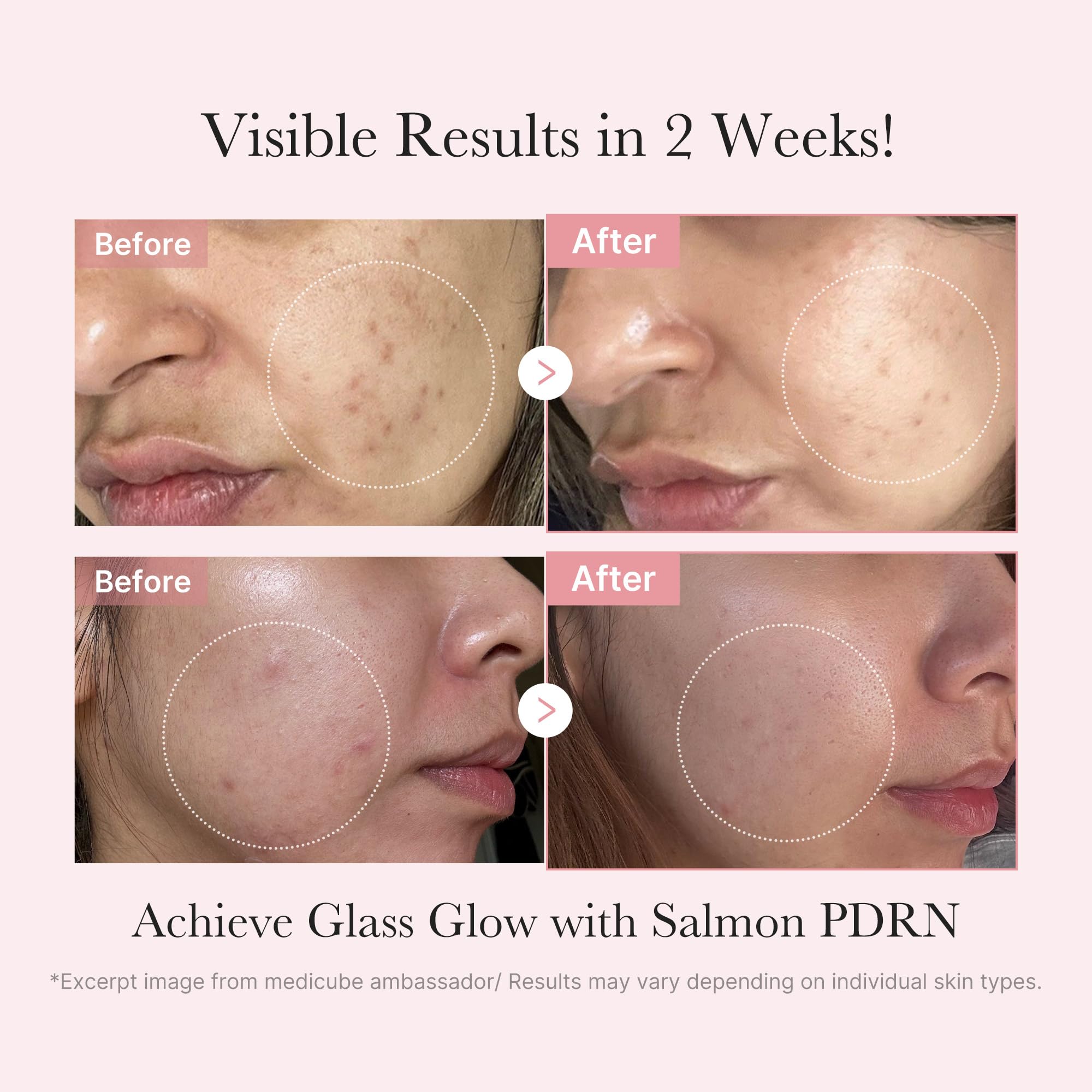 Medicube Pink PDRN Trio mask close-up highlighting creamy texture