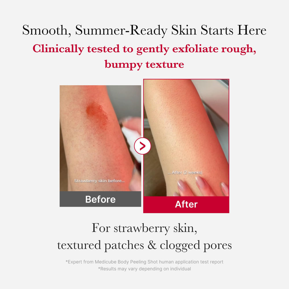 Medicube Red Body Peeling Shot spray on shoulders and chest for smoother skin