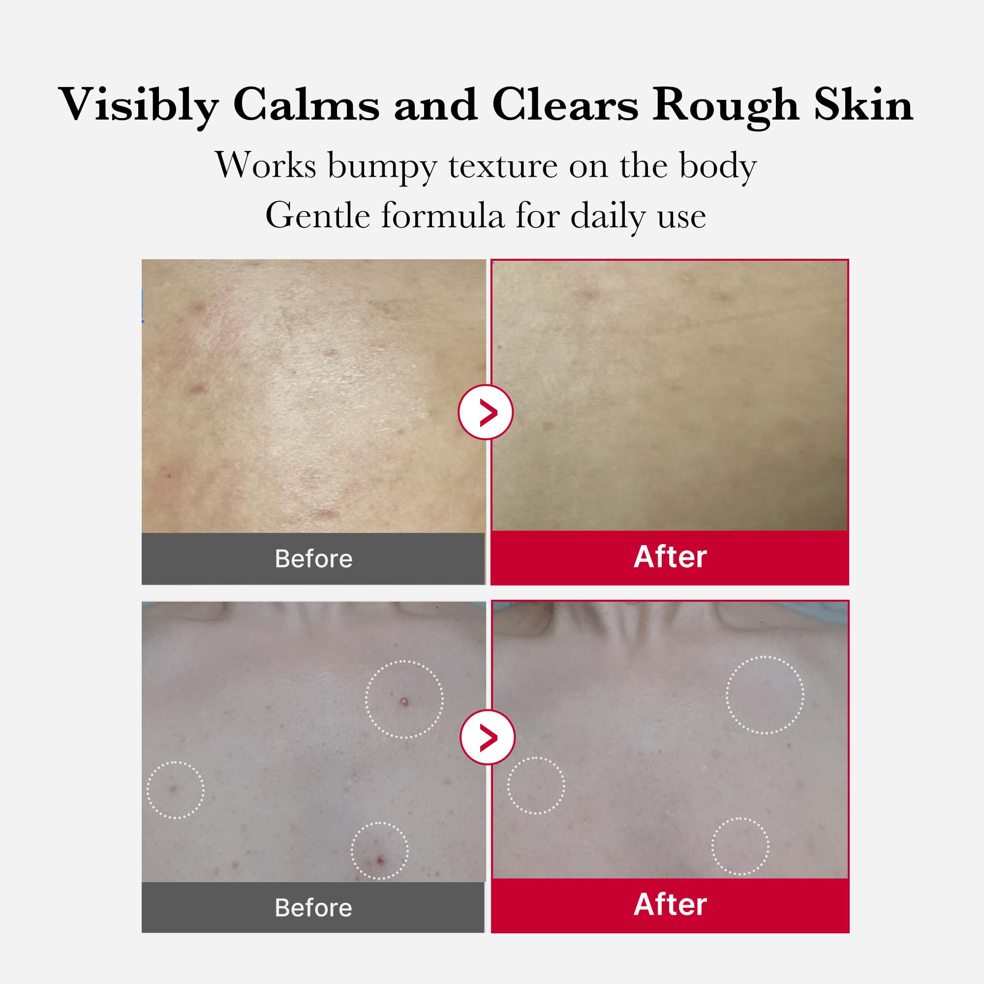 Medicube Red Body Peeling Shot bottle closeup for at-home exfoliation