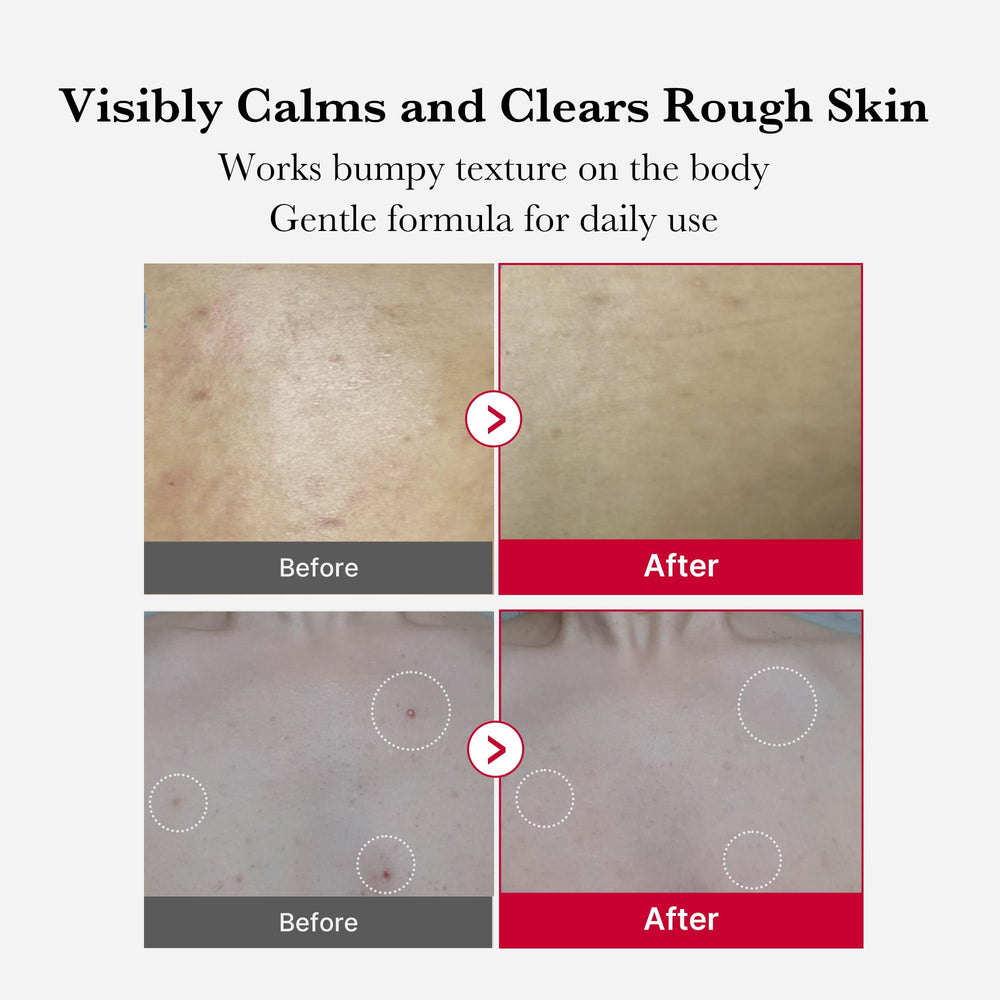 Medicube Red Body Peeling Shot bottle closeup for at-home exfoliation