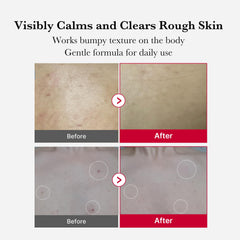 Medicube Red Body Peeling Shot bottle closeup for at-home exfoliation