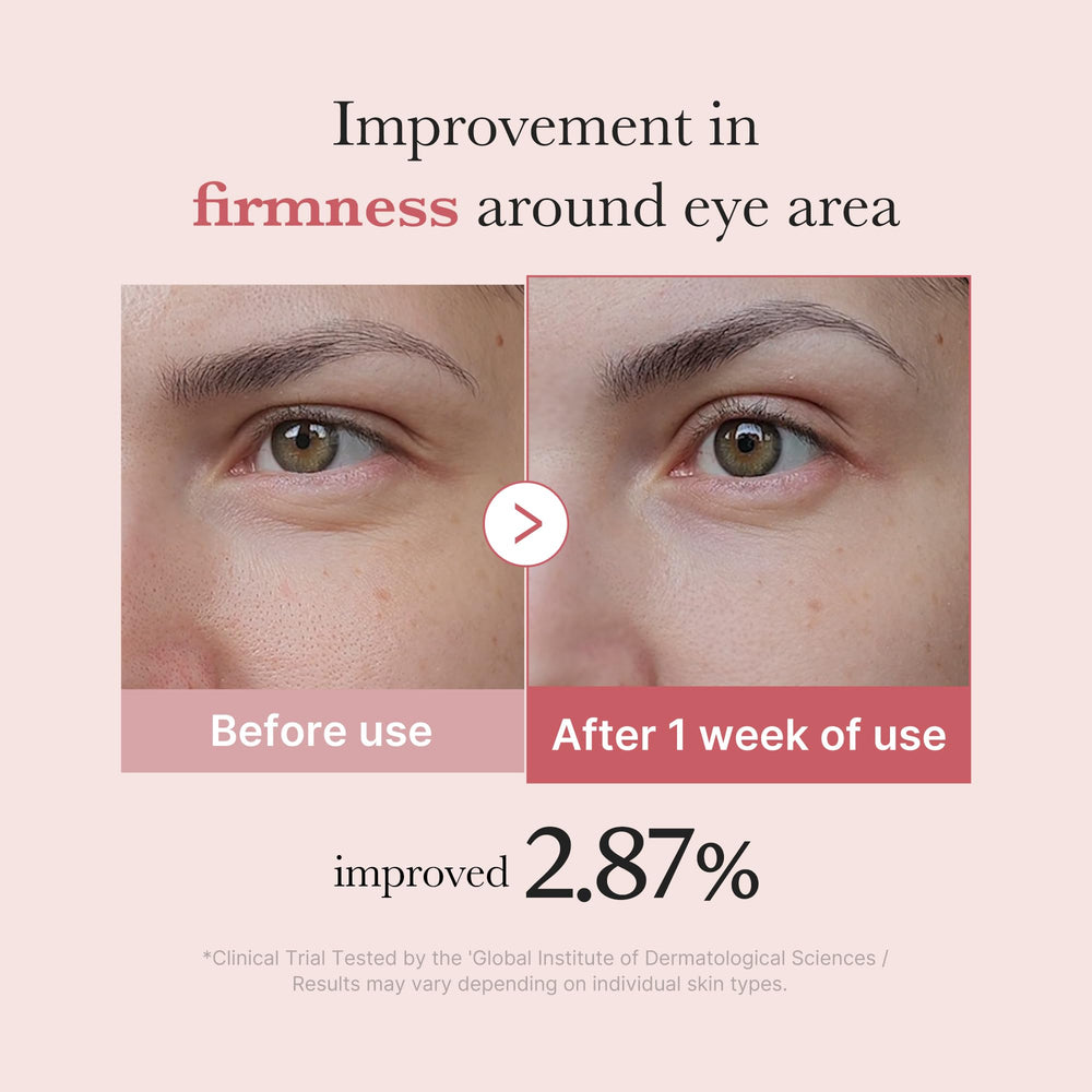 Medicube Salmon DNA PDRN Eye Serum niacinamide boost highlights brightening around eye area