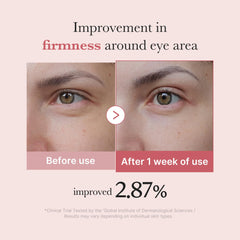 Medicube Salmon DNA PDRN Eye Serum niacinamide boost highlights brightening around eye area