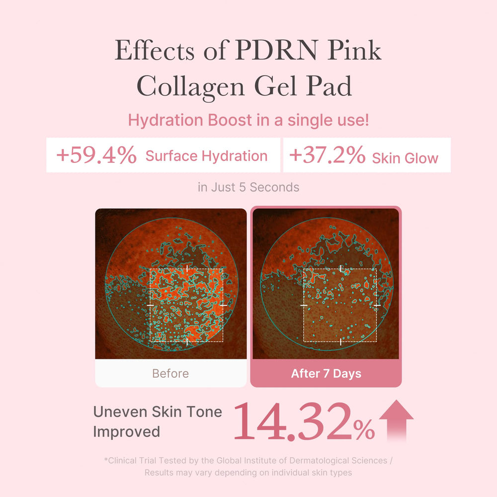 Medicube Salmon DNA PDRN jelly pad Niacinamide benefit for brighter, even tone