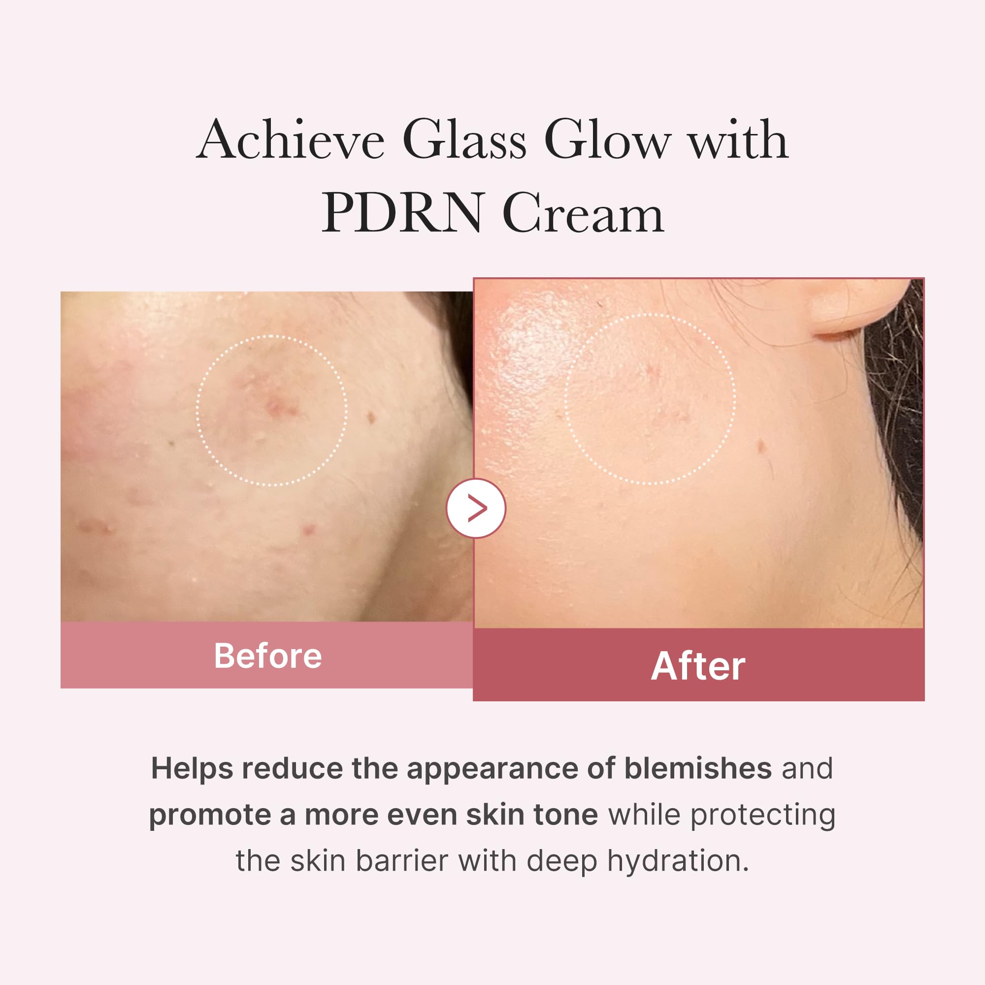 medicube Salmon DNA PDRN pink moisturizing cream swatch demonstrates quick absorption and smooth skin
