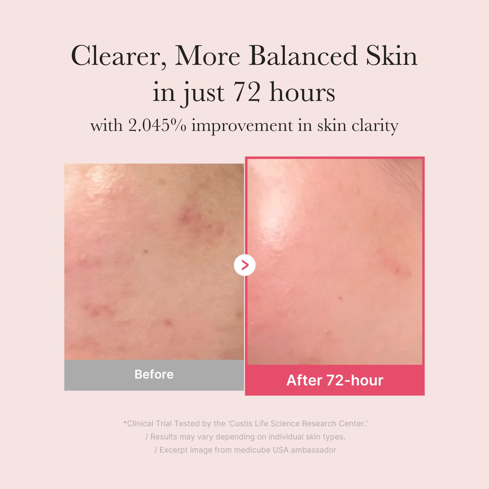 Medicube TXA+Niacinamide 15% Glow Serum dispense pump enables easy daily use.