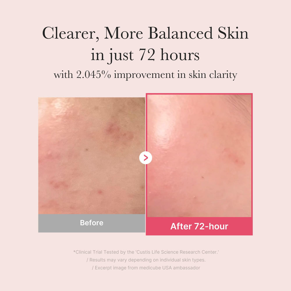 Medicube TXA+Niacinamide 15% Glow Serum dispense pump enables easy daily use.