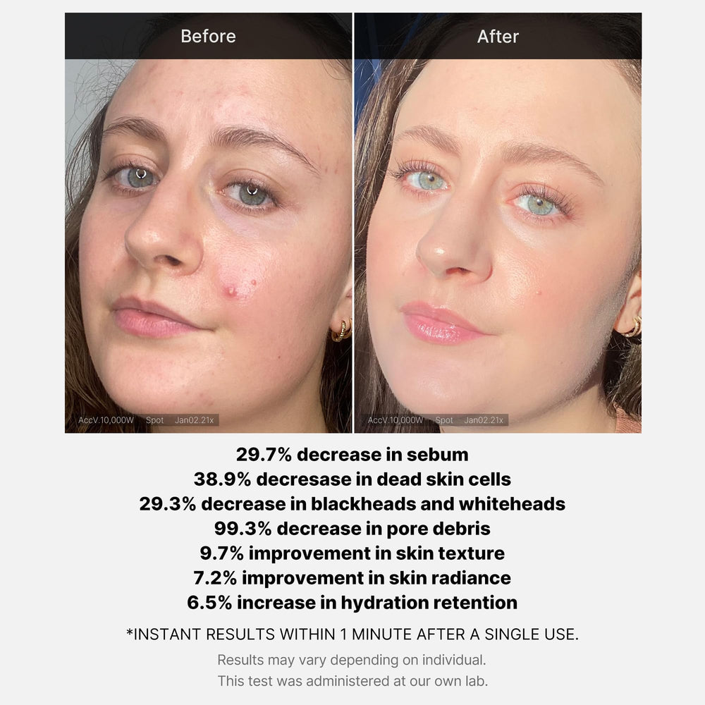 Medicube wash-off exfoliant pore detail highlights debris removal and texture improvement