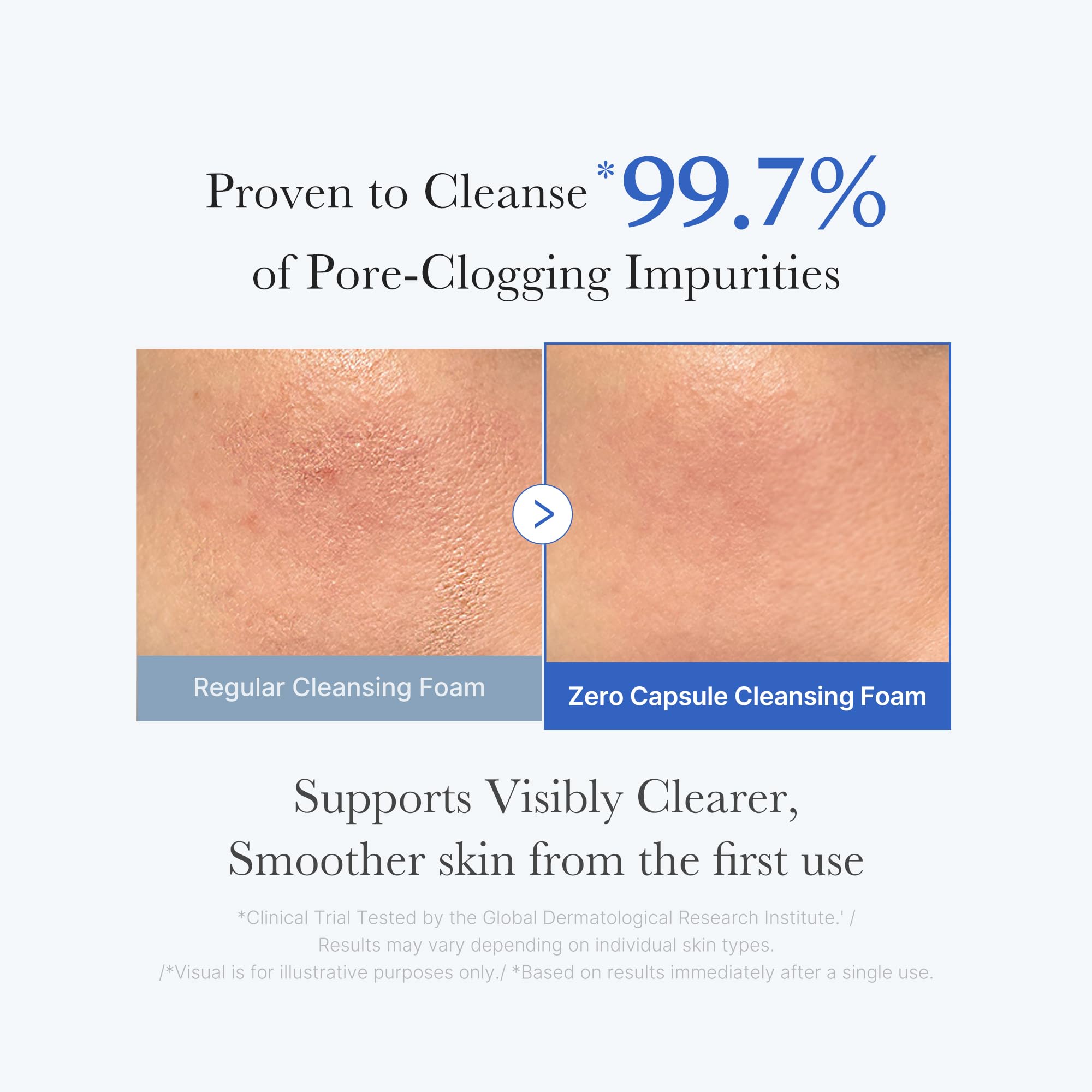 medicube Zero Pore capsule detail highlights blue capsule for pore care