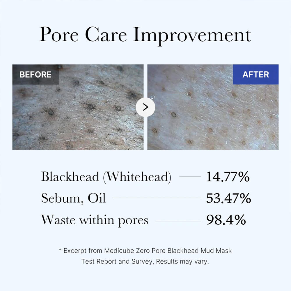 Medicube Zero Pore mud mask rinse-off reveals clarified pores after use.