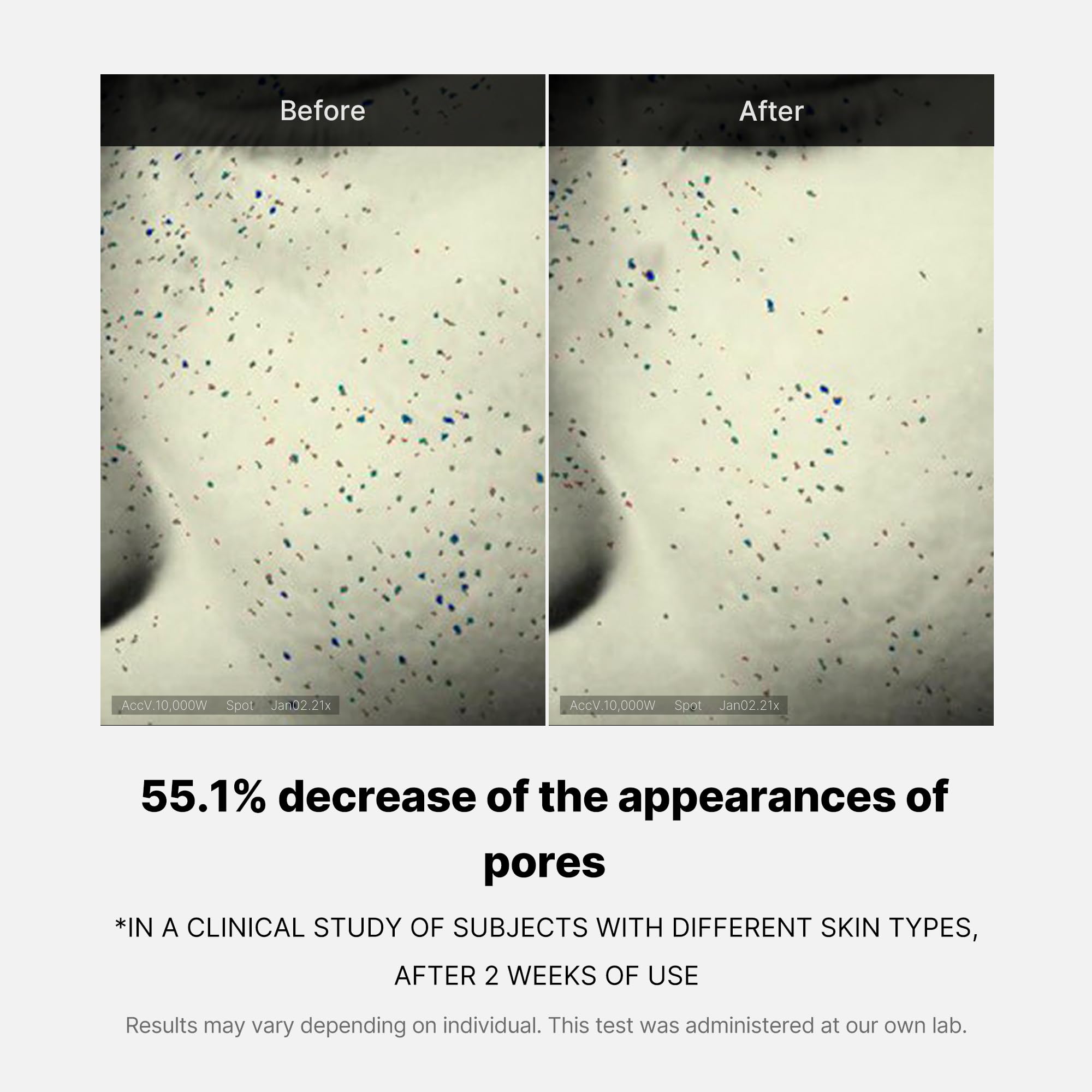 Medicube Zero Pore One-Day Cream salicylic-acid shot suggests gentle cleansing and pore care