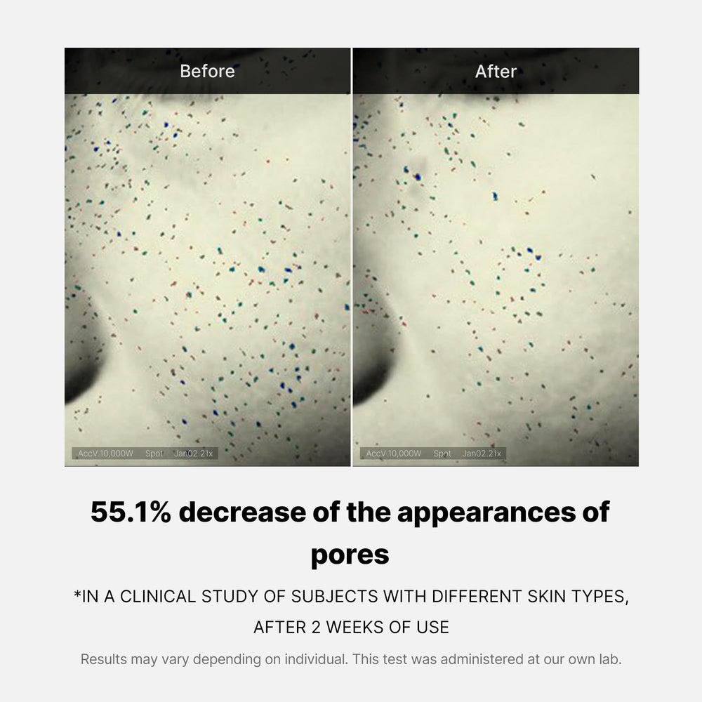 Medicube Zero Pore One-Day Cream salicylic-acid shot suggests gentle cleansing and pore care