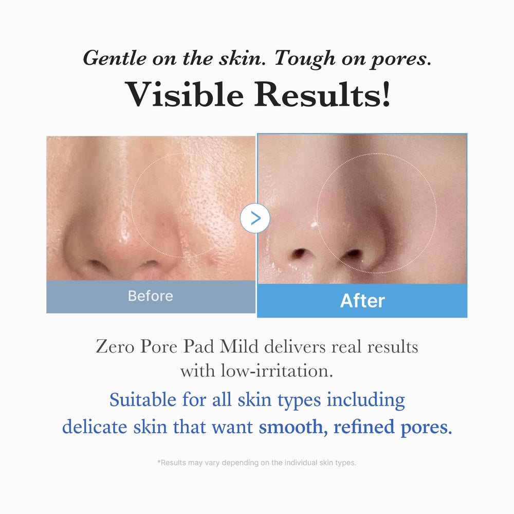 Medicube Zero Pore Pads Mild 2.0 before-after closeup hints pore refinement