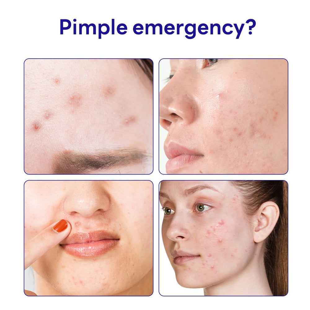 Mediheal Derma Clear closeup shows hydrocolloid patch ready to absorb exudate.