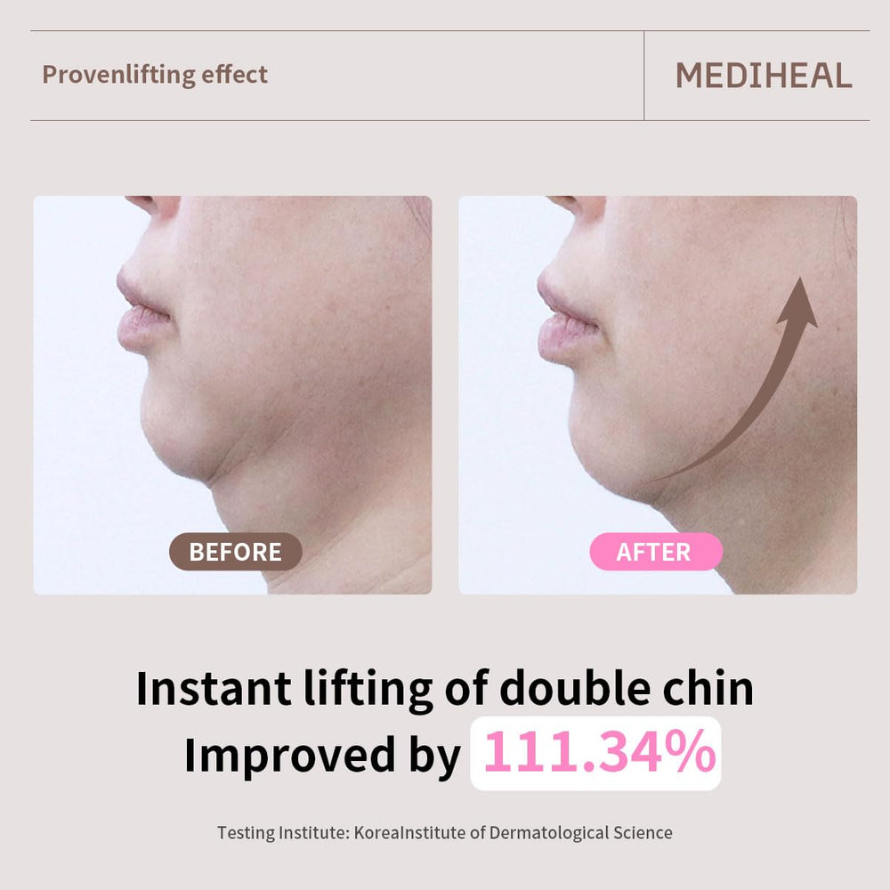 Mediheal lifting mask close-up retinol micro-particles delivering nourishment.