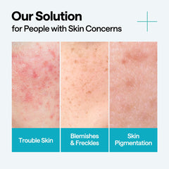 Mediheal Madecassoside Repair Serum applied on skin for calming, even tone.