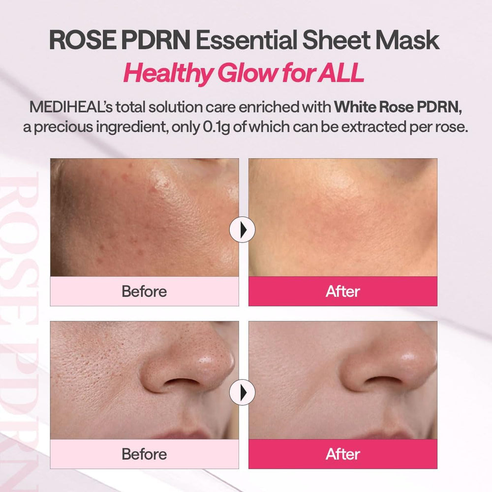 Mediheal Rose PDRN Essential Sheet Mask with hyaluronic acid provides deep hydration.