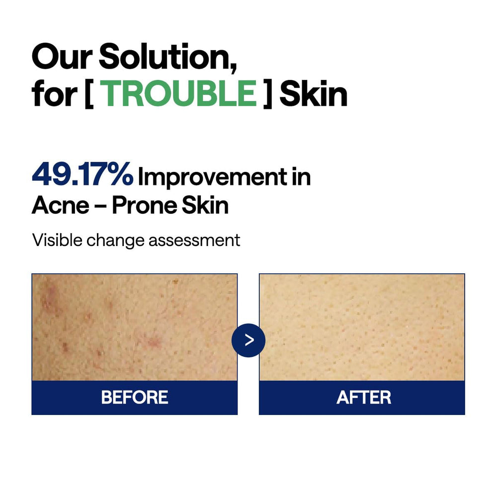 Mediheal Teatree Trouble Pad lactobacillus culture segment suggests probiotic-like balance for complexion.
