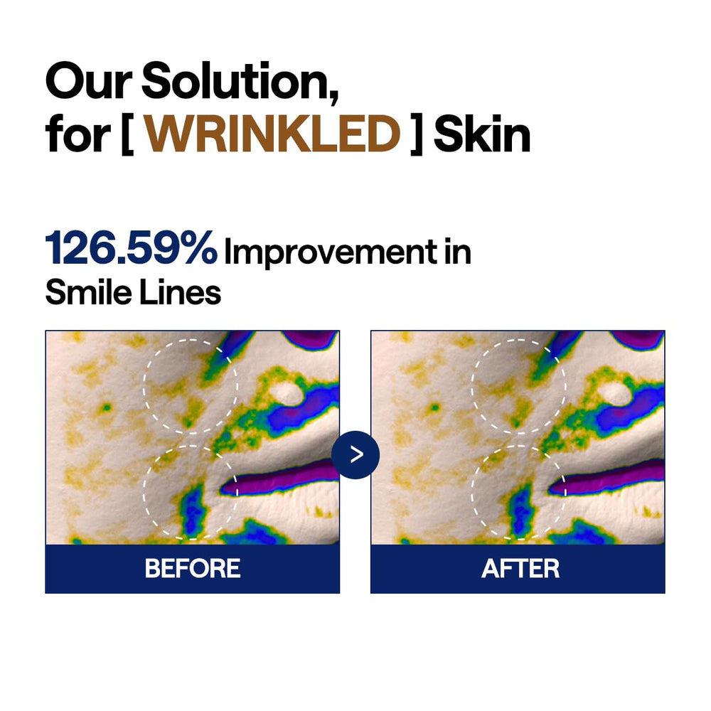 Mediheal Toner Pads Lifting Firming Application shows pads applied for a firming feel