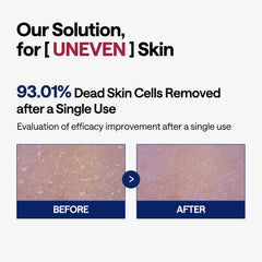 Mediheal Toner Pads Papaya Enzyme exfoliation closeup emphasizes natural enzymes