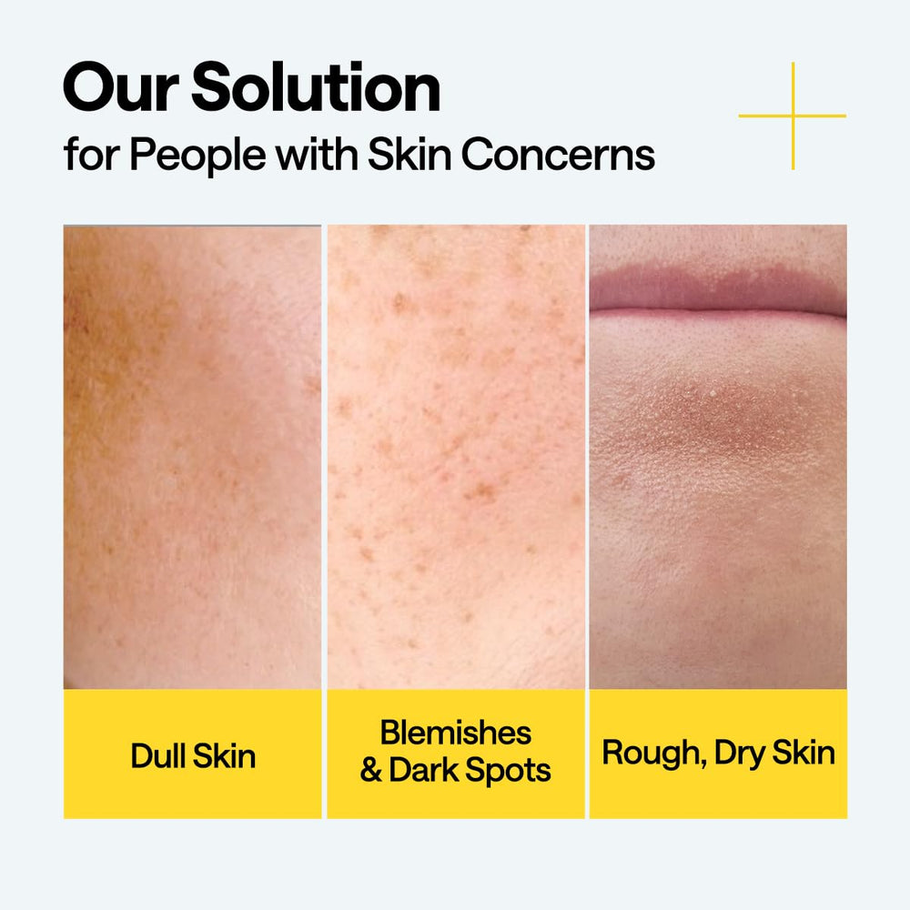 Mediheal Vitamin C serum on hand for easy daily application