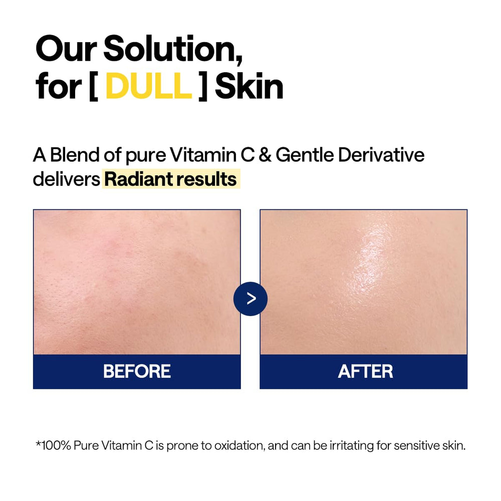 Graphic showing vitamin C, niacinamide and hyaluronic acid in Mediheal serum