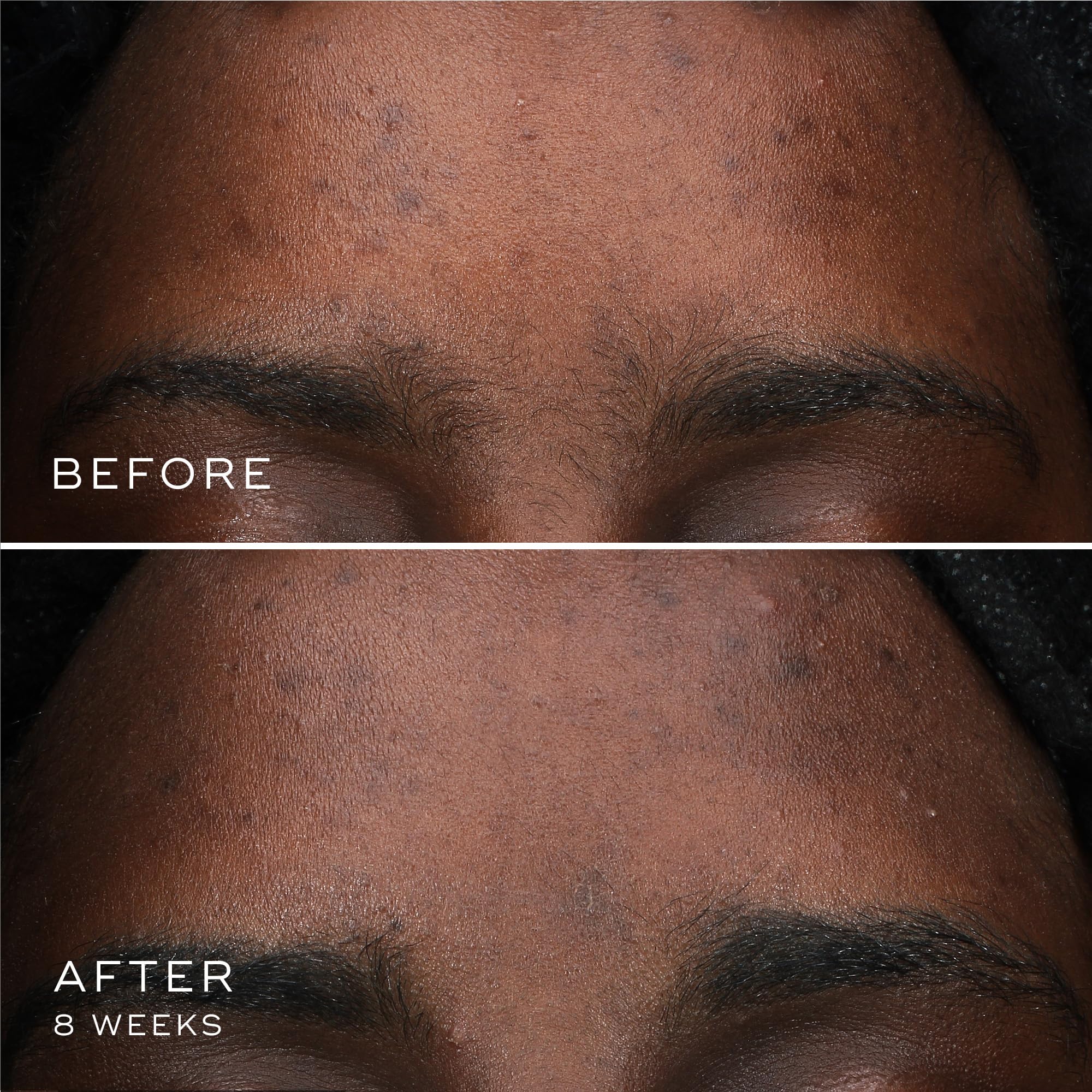 Medik8 Oxy-R Peptides Serum label closeup — vegan science-led formula.