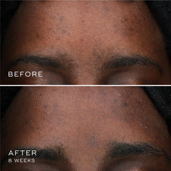 Medik8 Oxy-R Peptides Serum label closeup — vegan science-led formula.