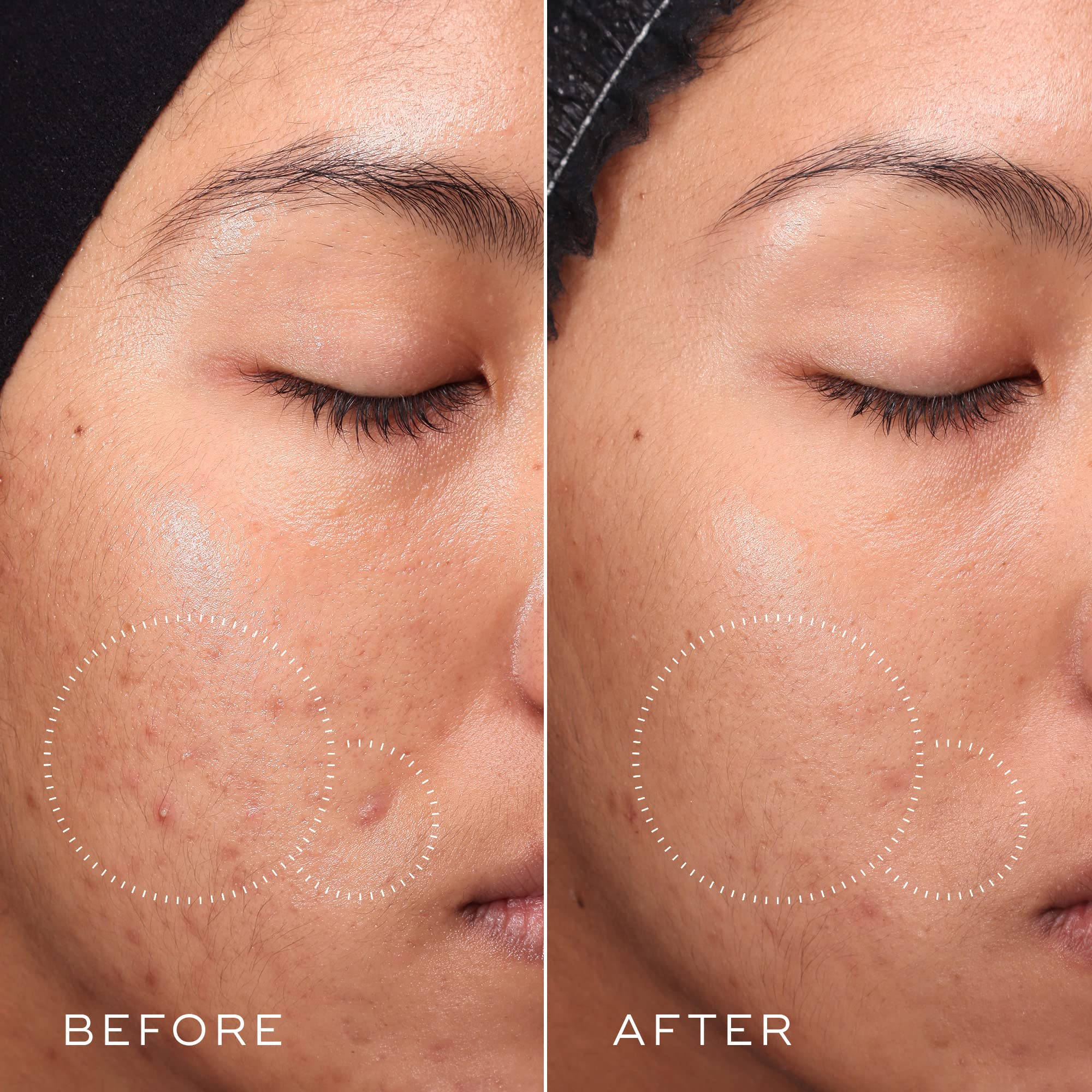 Medik8 Press and Clear toner ingredients spotlight tranexamic acid for a calmer complexion