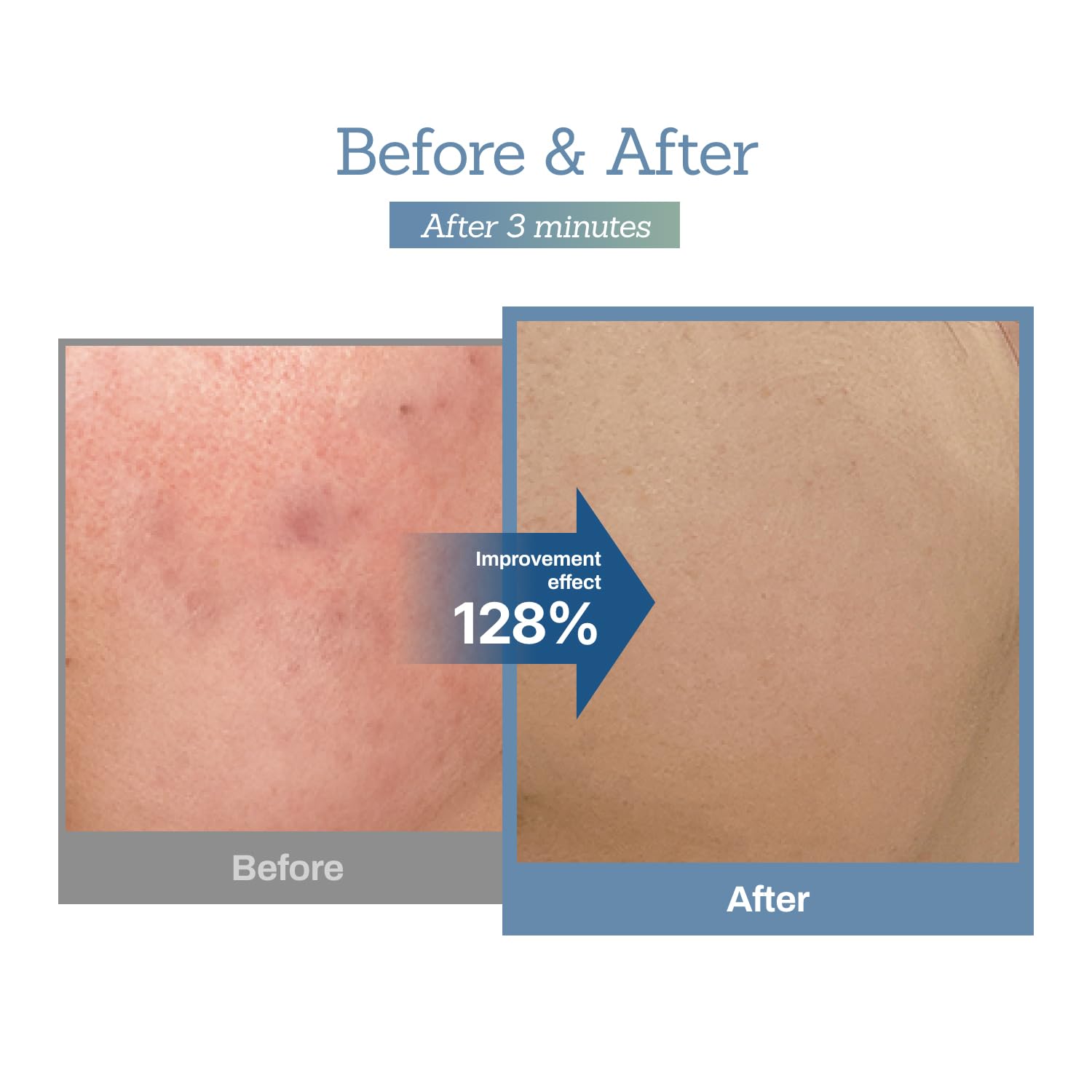 MEDITHERAPY Blue Centella Calming Cream close-up captures blue hue for calming vibes
