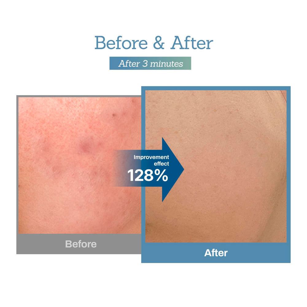 MEDITHERAPY Blue Centella Calming Cream close-up captures blue hue for calming vibes