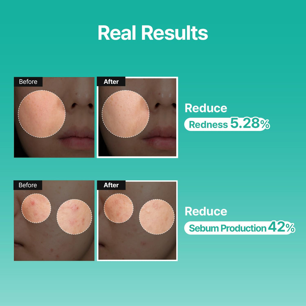 MEDITHERAPY PDRN milky texture application highlights quick absorption and non-sticky hydration.