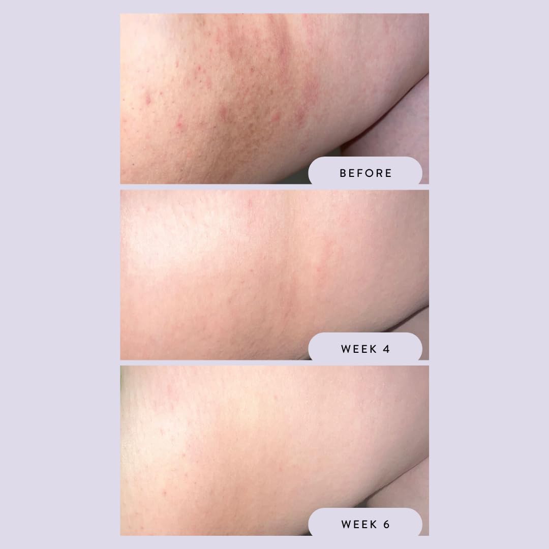 Megababe Night Rescue niacinamide detail highlights complexion brightening during nightly routine