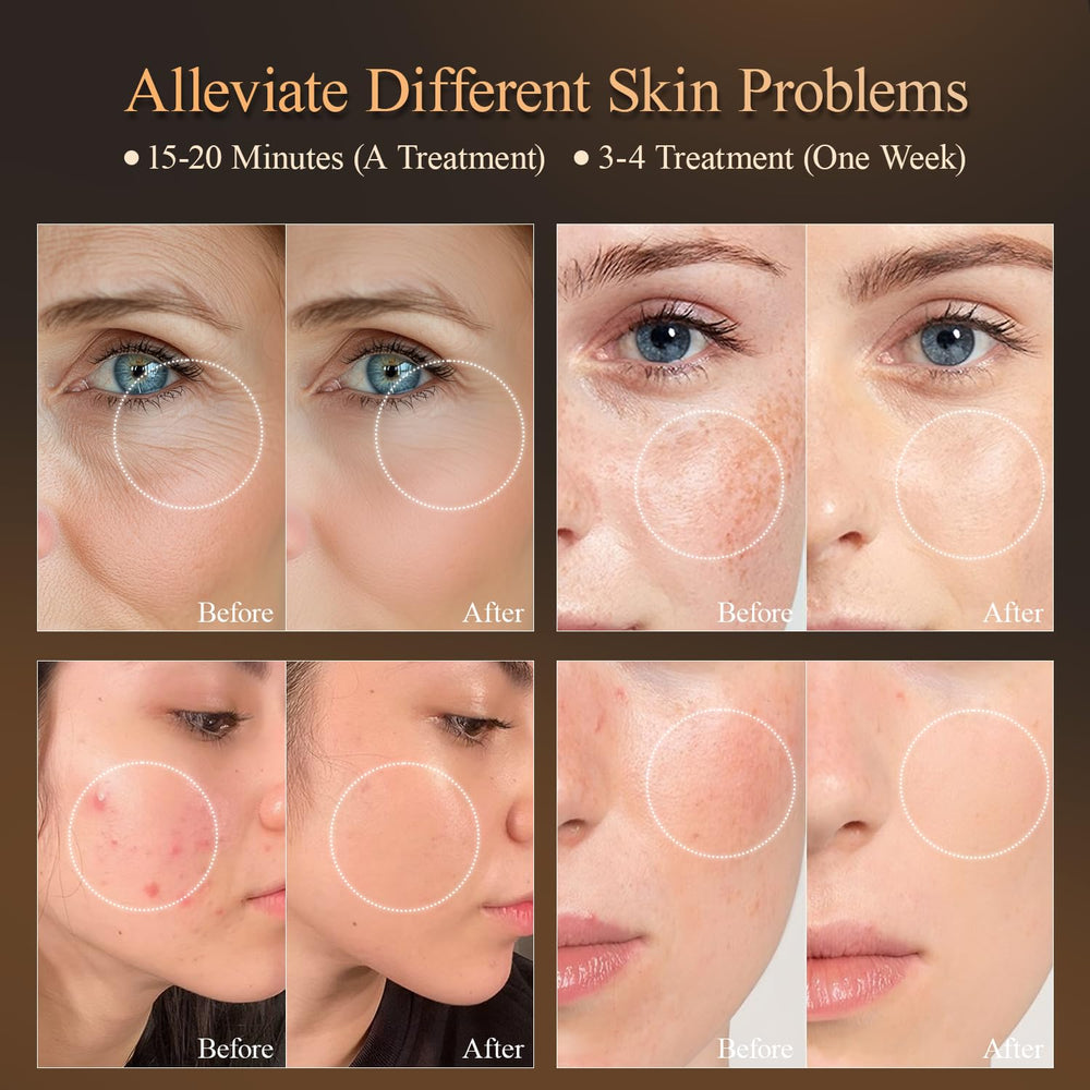 MEGELIN rechargeable battery for cordless LED skin therapy.
