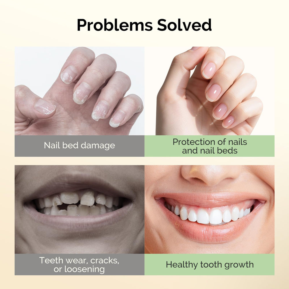 MelodySusie nail biting treatment brush-head highlights easy, mess-free application.